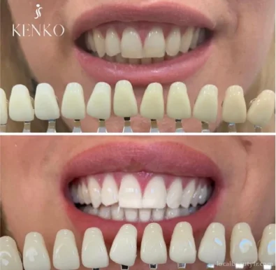 • KENKO Expert Soins Esthétiques • Extension De Cils • Dermopigmentation • Blanchiment Dentaire •, Centre-Val de Loire - Photo 3