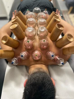 Monsieur Hijama - Cupping Therapy Montreuil 93, Montreuil - Photo 2