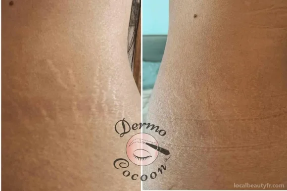 Dermo Cocoon (Hello Cocoon)- Maquillage Permanent, Provence-Alpes-Côte d'Azur - Photo 3